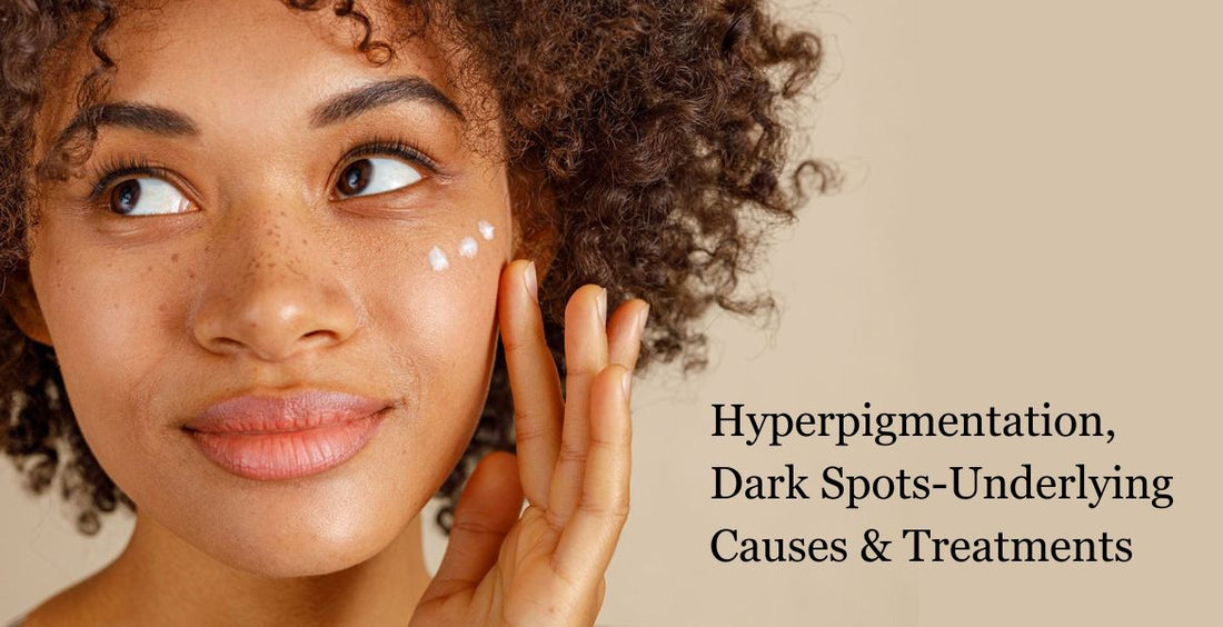 Hyperpigmentation,Dark Spots-Underlying Causes & Treatments :- Melanin 🏾 is the pigment that imparts colour to the skin. Hyperpigmentation refers to a condition where there is excess production of this pigment.
